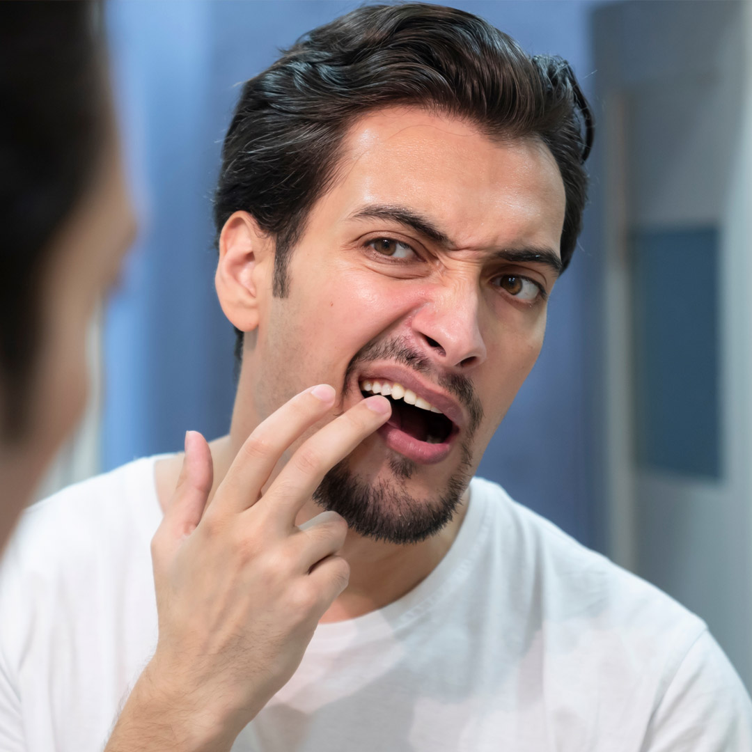 Why Immediate Attention Is Essential for Dental Fillings
