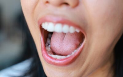 What To Do If You Lose A Dental Filling Or Crown?