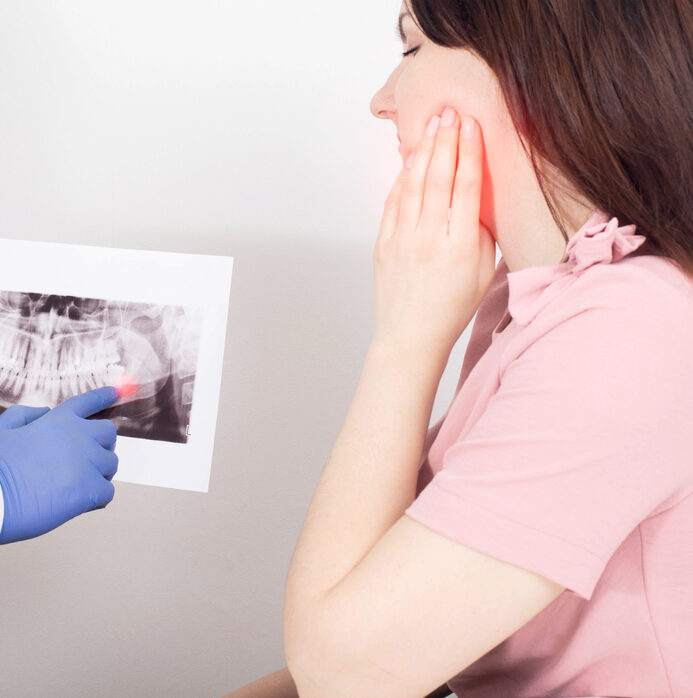 When is Wisdom Tooth Extraction necessary?
