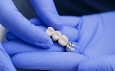 What Are Emergency Options For Lost Dental Bridges?